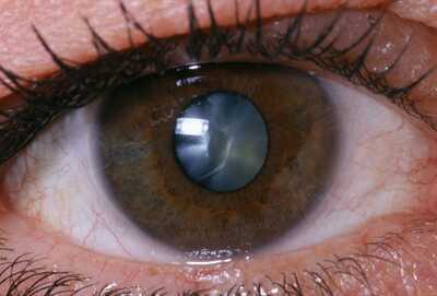 princ_rm_photo_of_close_up_of_eye